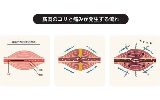 イラスト