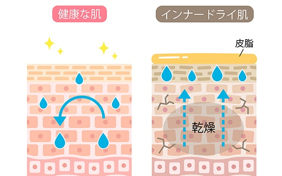 イラスト